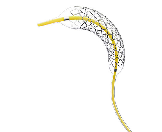 Stent frontier